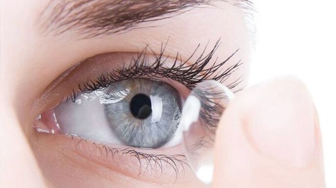 The optical method of correcting vision is wearing contact lenses. 