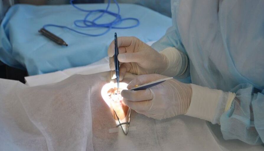 Eye surgery to help restore vision